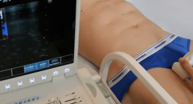 Diagnostic options for varicose veins of the lower limbs