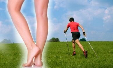 Allowed types of walking for varicose veins